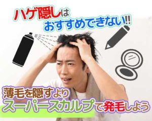 松阪市で薄毛を隠す「ハゲ隠し」がおすすめできない理由とは？